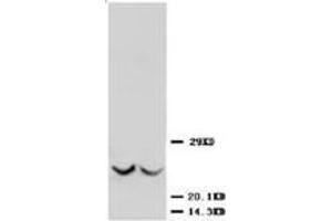 Western blot analysis of rat kidney tissue lysis using TIMP3 antibody (TIMP3 Antikörper  (C-Term))
