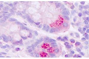 Anti-MLNR / Motilin Receptor antibody IHC staining of human small intestine, paneth cells.