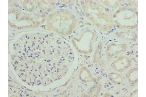Immunohistochemistry of paraffin-embedded human kidney tissue using ABIN7171040 at dilution of 1:100 (SUSD6 (AA 144-303) Antikörper)