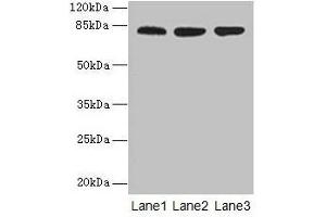 Western blot All lanes: ACAP1 antibody at 4 μg/mL Lane 1: Mouse lung tissue Lane 2: Jurkat whole cell lysate Lane 3: K562 whole cell lysate Secondary Goat polyclonal to rabbit IgG at 1/10000 dilution Predicted band size: 82 kDa Observed band size: 82 kDa (ACAP1 Antikörper  (AA 1-266))