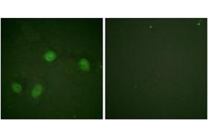 Immunofluorescence analysis of HeLa cells, using C-RAF (Phospho-Ser621) Antibody. (RAF1 Antikörper  (pTyr621))