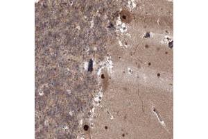 Immunohistochemical staining of human cerebellum with COPS4 polyclonal antibody  shows strong nuclear and cytoplasmic positivity in Purkinje cells at 1:20-1:50 dilution.