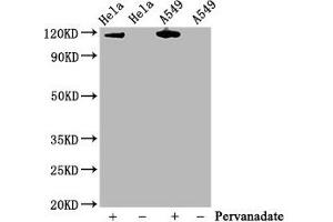 Western Blot Positive WB detected in Hela whole cell lysate,A549 whole cell lysate(treated with Pervanadate or not) All lanes Phospho-JAK2 antibody at 0. (Rekombinanter JAK2 Antikörper  (pTyr1007, pTyr1008))