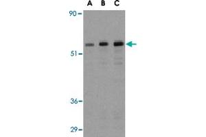 Western blot analysis of MAP3K7IP1 in NIH/3T3 cell lysate with MAP3K7IP1 polyclonal antibody  at (A) 0. (TAB1 Antikörper  (Internal Region))