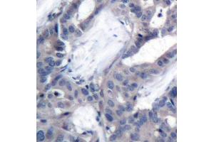 Immunohistochemistry (IHC) image for anti-Mitogen-Activated Protein Kinase Kinase 2 (MAP2K2) (pThr394) antibody (ABIN3019566)