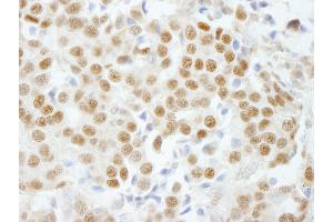 Immunohistochemistry (IHC) image for anti-General Transcription Factor IIIC, Polypeptide 5 (GTF3C5) (AA 469-519) antibody (ABIN7448588)