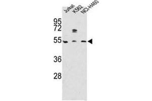 Western blot analysis of APOA4 antibody and Jurkat, K562, NCI-H460 lysate (APOA4 Antikörper  (AA 49-79))