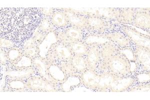 Detection of PCT in Human Kidney Tissue using Monoclonal Antibody to Procalcitonin (PCT) (Procalcitonin Antikörper  (AA 26-141))