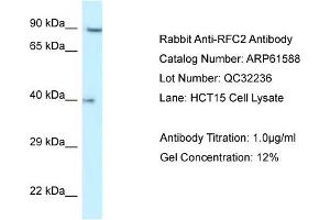 Western Blotting (WB) image for anti-Replication Factor C (Activator 1) 2, 40kDa (RFC2) (N-Term) antibody (ABIN2788844)