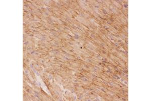 Anti-GLUT4 Picoband antibody,  IHC(F): Rat Cardiac Muscle Tissue (GLUT4 Antikörper  (AA 333-509))