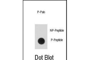 Dot blot analysis of anti-Phospho-hSTAT5a-p Phospho-specific Antibody (ABIN389667 and ABIN2839646) on nitrocellulose membrane. (STAT5A Antikörper  (pSer726))