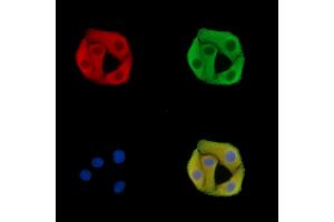 ABIN7095715 and ABIN7099777 staining Hela cells by IF/ICC. (SLC25A29 Antikörper)