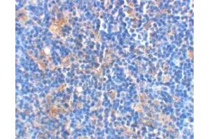 Immunohistochemical staining of rat thymus using AP30114PU-N Bad antibody at 2 μg/ml. (BAD Antikörper)