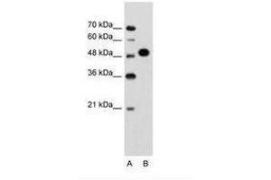 Image no. 1 for anti-Makorin Ring Finger Protein 1 (MKRN1) (AA 101-150) antibody (ABIN203479) (MKRN1 Antikörper  (AA 101-150))
