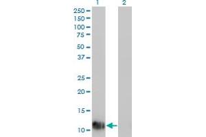 Western Blot analysis of FABP1 expression in transfected 293T cell line by FABP1 monoclonal antibody (M01), clone 4G5.