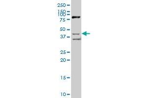 SCAP2 polyclonal antibody (A01), Lot # 050921JC01. (SKAP2 Antikörper  (AA 1-359))