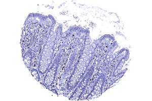 Colon descendes mucosa In the normal colon MPO positive granulocytes occur within small capillaries and also the stroma of the lamina propria (Myeloperoxidase Antikörper)