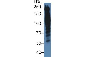 Western blot analysis of Human HeLa cell lysate, using Human PPL Antibody (5 µg/ml) and HRP-conjugated Goat Anti-Rabbit antibody ( (PPL Antikörper  (AA 1439-1716))