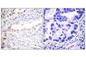 Immunohistochemistry (IHC) image for anti-SUMO1 Activating Enzyme Subunit 2 (UBA2) (C-Term) antibody (ABIN1848873) (UBA2 Antikörper  (C-Term))