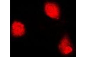 Immunofluorescent analysis of MTAP staining in Hela cells. (MTAP Antikörper)