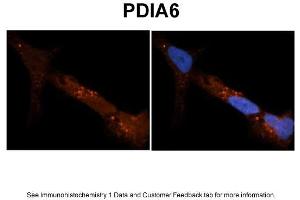 Sample Type: NT2 cells Red: Antibody Blue: DAPI Primary Dilution: 1ug/50ul antibody Secondary Antibody: Alexa goat anti-rabbit 594 Image Submitted by: Yuzhi Chen, University of Arkansas for Medical Sciences (PDIA6 Antikörper  (N-Term))