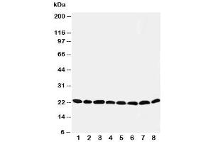 Western blot testing of Peroxiredoxin 5 antibody and Lane 1:  rat brain (Peroxiredoxin 5 Antikörper  (C-Term))