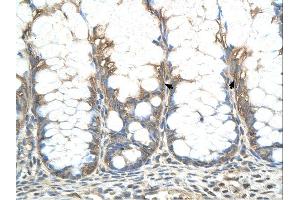 Immunohistochemistry (IHC) image for anti-Cysteine-Rich Hydrophobic Domain 2 (CHIC2) (N-Term) antibody (ABIN2782770)