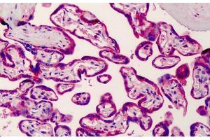 Human Placenta: Formalin-Fixed, Paraffin-Embedded (FFPE) (SREBF2 Antikörper  (AA 434-483))