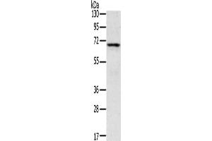 Gel: 8 % SDS-PAGE, Lysate: 40 μg, Lane: Human fetal brain tissue, Primary antibody: ABIN7192841(TNK1 Antibody) at dilution 1/400, Secondary antibody: Goat anti rabbit IgG at 1/8000 dilution, Exposure time: 5 minutes (TNK1 Antikörper)