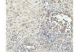 IHC analysis of EDC4 using anti-EDC4 antibody (ABIN7599694). (EDC4 Antikörper  (AA 1082-1388))