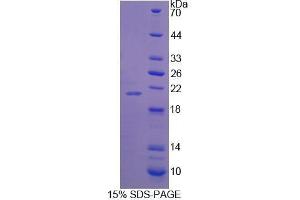 Image no. 1 for Synaptopodin (SYNPO) (AA 781-920) protein (His tag) (ABIN6239968) (SYNPO Protein (AA 781-920) (His tag))