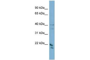 WB Suggested Anti-DYDC1 Antibody Titration: 0. (DYDC1 Antikörper  (Middle Region))