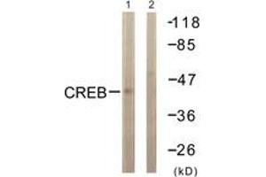 Western blot analysis of extracts from HeLa cells, treated with Insulin 0. (CREB1 Antikörper  (AA 91-140))