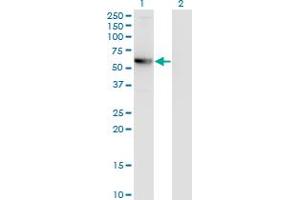 Western Blot analysis of CCDC83 expression in transfected 293T cell line by MGC34732 monoclonal antibody (M01), clone 3E3. (CCDC83 Antikörper  (AA 341-444))