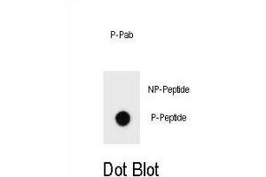 Dot blot analysis of Phospho-ERBB2- Antibody Phospho-specific Pab h on nitrocellulose membrane.
