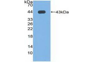 Detection of Recombinant PLD, Human using Polyclonal Antibody to Phospholipase D (PLD) (Phospholipase D Antikörper  (AA 725-1074))