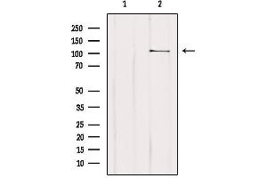 Western blot analysis of extracts from Hybridoma cells, using MTHFD1L Antibody.