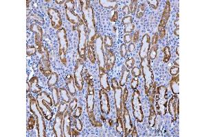 IHC analysis of KMO using anti-KMO antibody (ABIN7600958). (KMO Antikörper  (AA 26-372))