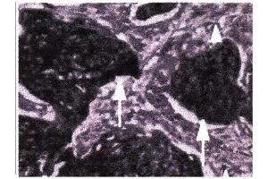 Immunohistochemistry (IHC) image for anti-Matrix Metallopeptidase 9 (Gelatinase B, 92kDa Gelatinase, 92kDa Type IV Collagenase) (MMP9) (N-Term) antibody (ABIN307120)
