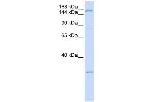 WB Suggested Anti-ZNF687 Antibody Titration:  0. (ZNF687 Antikörper  (C-Term))