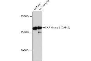Western blot analysis of extracts of various cell lines, using DAP Kinase 1 (D) Rabbit mAb (ABIN7266711) at 1:1000 dilution. (DAP Kinase 1 Antikörper)