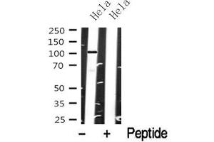 Western blot analysis of EPHA8 in lysates of Hela, using EPHA8 Antibody(ABIN6272805).