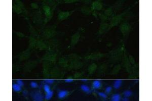 Immunofluorescence analysis of NIH/3T3 cells using TRPV1 Polyclonal Antibody at dilution of 1:100. (TRPV1 Antikörper)