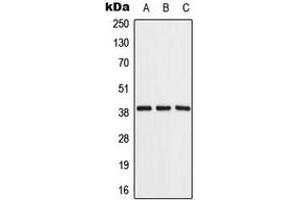 Western blot analysis of ALDOB expression in Raji (A), NIH3T3 (B), rat liver (C) whole cell lysates. (ALDOB Antikörper  (Center))