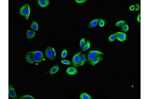 Immunofluorescent analysis of HepG2 cells using ABIN7172377 at dilution of 1:100 and Alexa Fluor 488-congugated AffiniPure Goat Anti-Rabbit IgG(H+L) (TRAPPC9 Antikörper  (AA 780-1030))