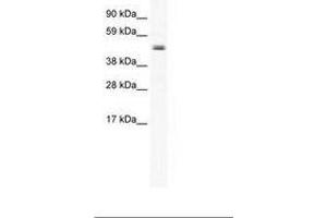 Image no. 1 for anti-Elongator Acetyltransferase Complex Subunit 4 (ELP4) (AA 230-279) antibody (ABIN202485) (ELP4 Antikörper  (AA 230-279))