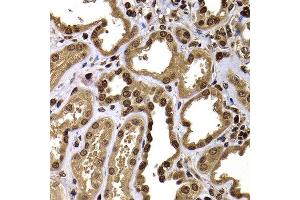 Immunohistochemistry of paraffin-embedded human kidney using GPS1 antibody at dilution of 1:100 (x400 lens). (GPS1 Antikörper)