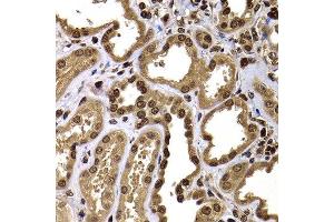 Immunohistochemistry of paraffin-embedded human kidney using GPS1 antibody at dilution of 1:100 (x400 lens).