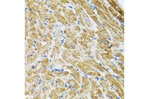 Immunohistochemistry of paraffin-embedded rat heart using POLG2 antibody (ABIN5974040) at dilution of 1/100 (40x lens). (POLG2 Antikörper)