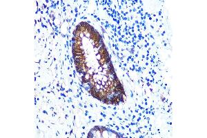 Immunohistochemistry (IHC) image for anti-Galectin 3 (LGALS3) antibody (ABIN7267337)